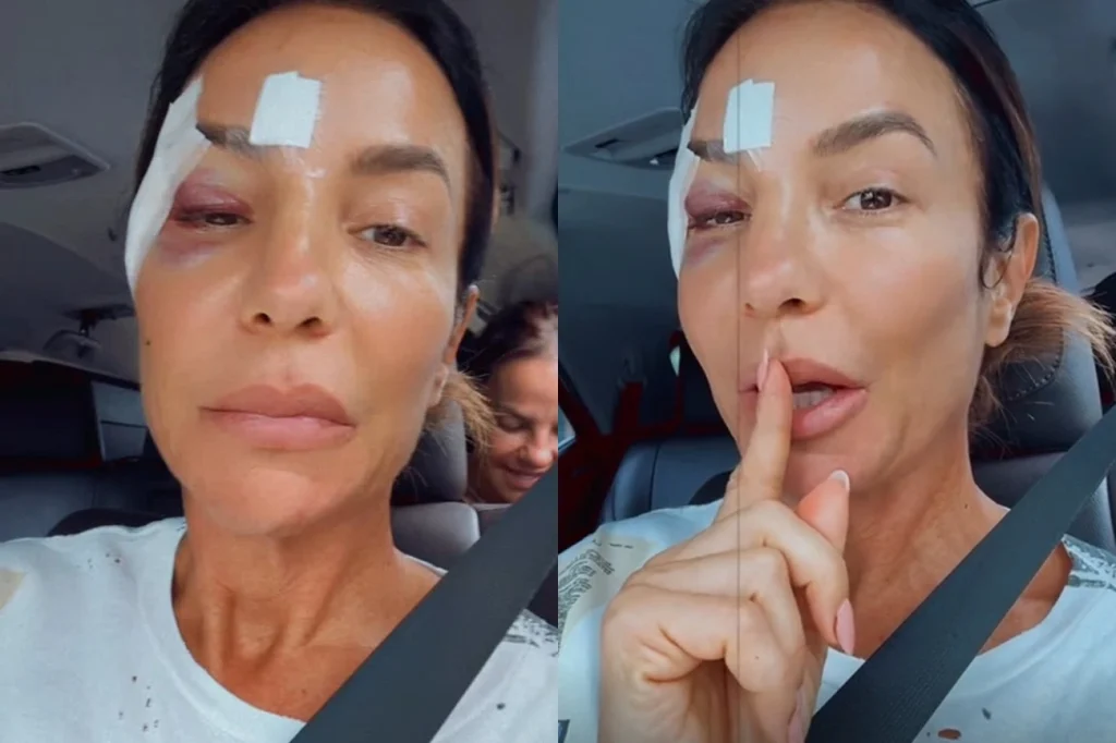 Ivete Sangalo atualiza saúde agora após desmaio e internação veja vídeo